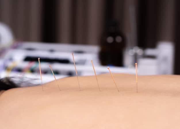 A close-up shot of acupuncture needles being applied to someone's back, with a focus on the precision and care involved in the process. The setting is a clean and professional acupuncture clinic.